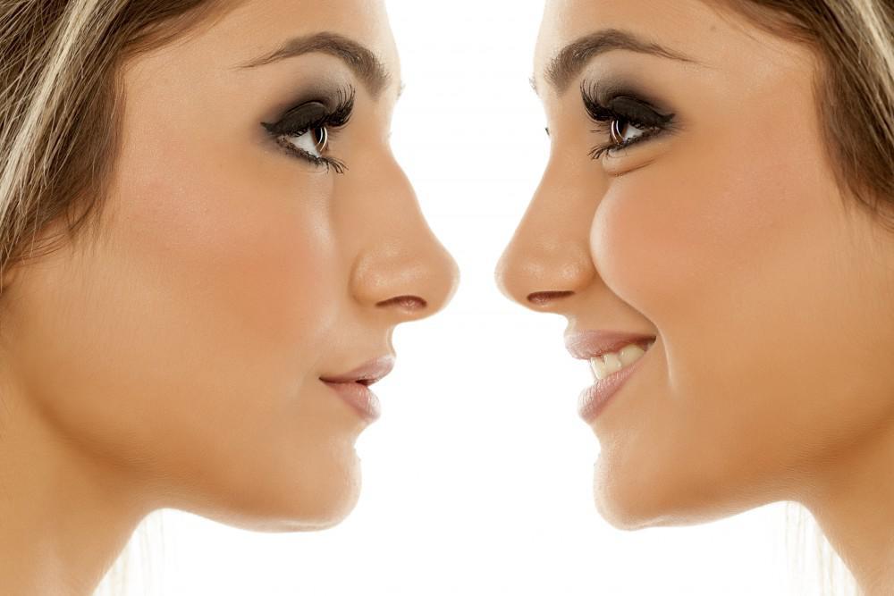 Face Surgery